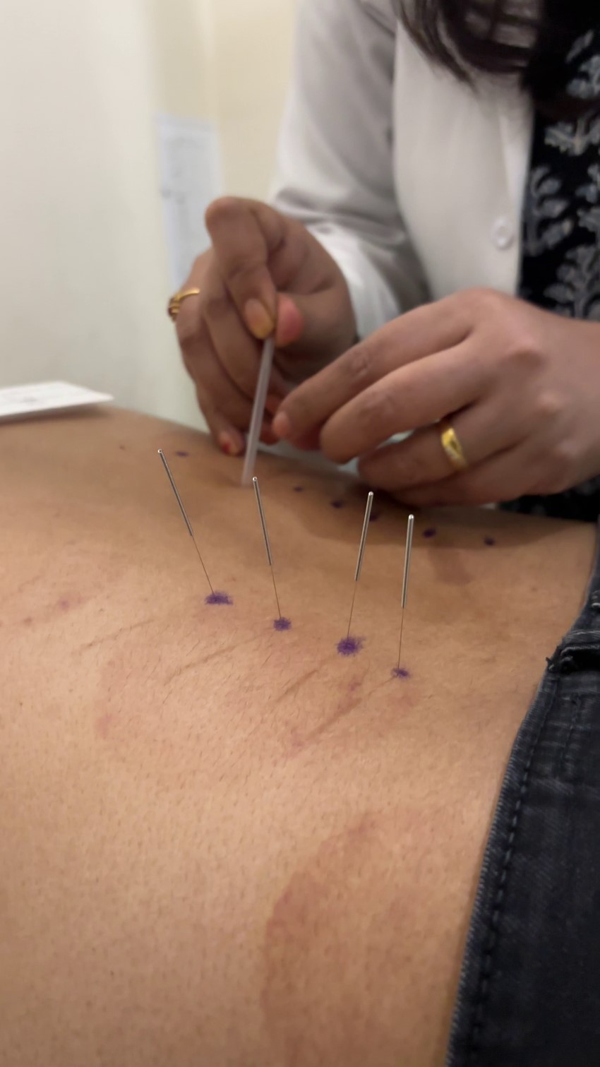 Patient 5 at Alexa Healthcare